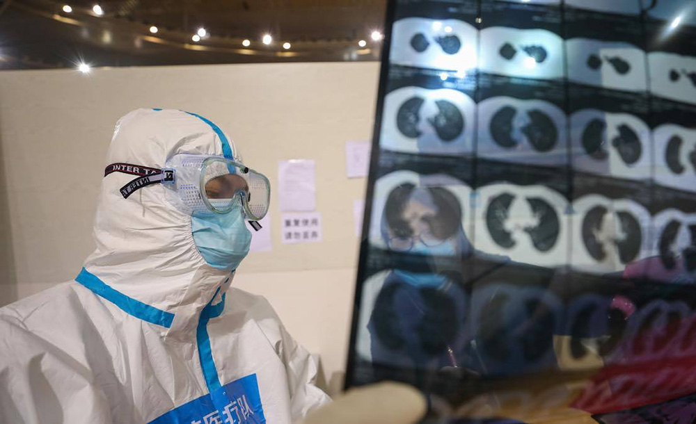 Médico examina raio-x de pacientes infectados com o coronavírus, em hospital de Wuhan, na China